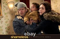 Shameless The Complete Series Import