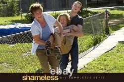 Shameless The Complete Series Import