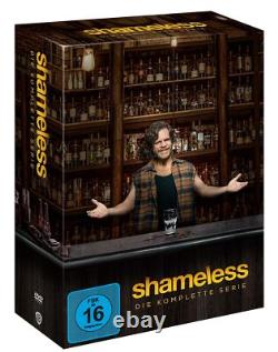 Shameless Die Komplette Serie Import